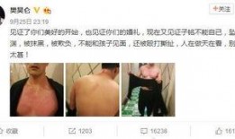 娱乐圈精灵哥是谁 吃瓜,他是谁？